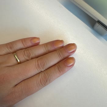 Flormar Oje Sonrası Kalıcı Lekelerle Karşılaştım