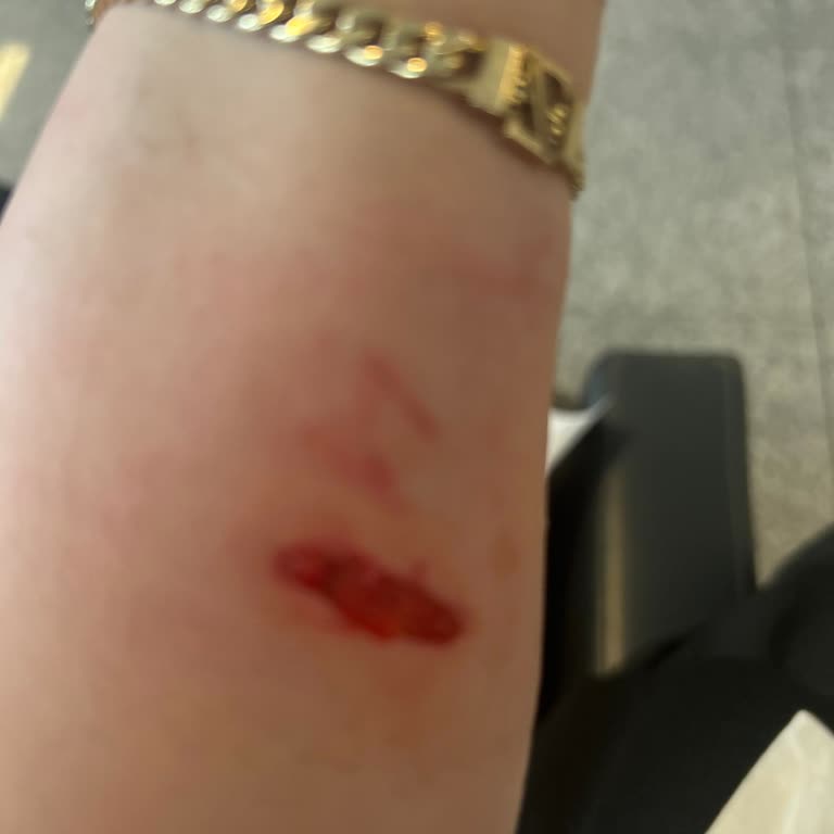 Acil Serviste Bekleme Çilesi