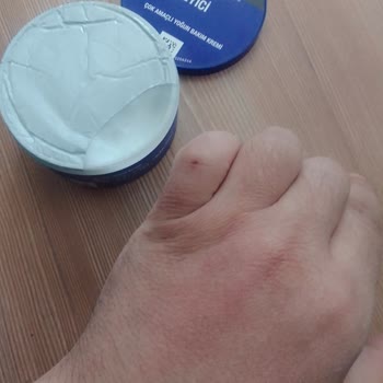 Neutrogena Krem Kaşıntı Ve Kuruluk Sorunu