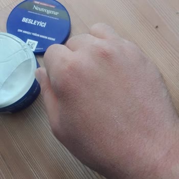 Neutrogena Krem Kaşıntı Ve Kuruluk Sorunu