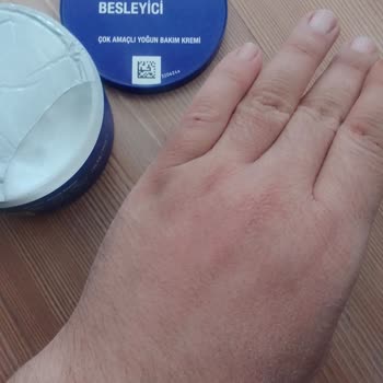 Neutrogena Krem Kaşıntı Ve Kuruluk Sorunu