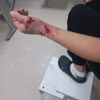 Okur Duşakabin Silerken Cam Patladı