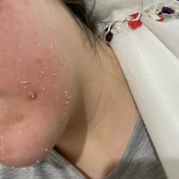 Bioderma Güneş Kremi Hayal Kırıklığı
