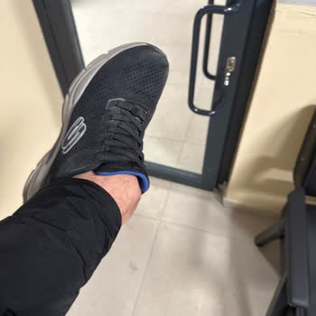 Skechers Ayakkabı Tabanı Sorunu