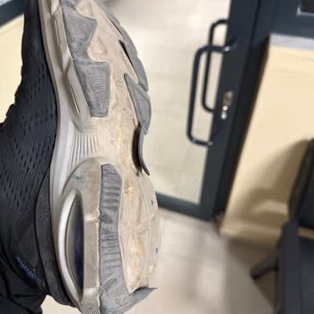 Skechers Ayakkabı Tabanı Sorunu