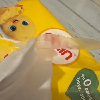 Dalin Islak Mendil Cilt Tahrişi Ve Kalite Sorunları