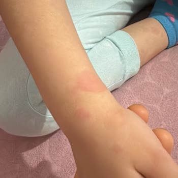 Liva Pastanesi Sağlıksız Gıda Boyasıyla Gelen Tehlike