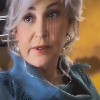 Toshiba TV'de Sürekli Büyüyen Ekran Çizikleri