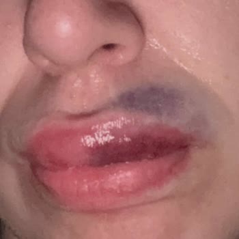 Risee Beauty Studio'dan Şikayetçiyim