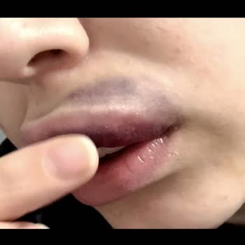 Risee Beauty Studio'dan Şikayetçiyim