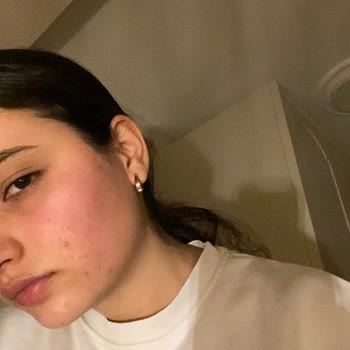 Bioderma Hydrabio Jel Krem Ciltte Tahrişe Sebep Oldu