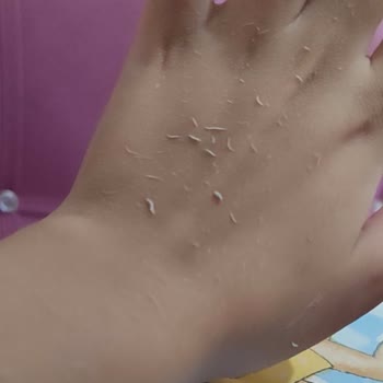 Bozuk Ürün Ve Hasarlı Paket Sorunu