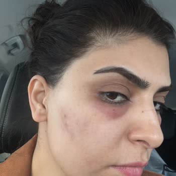Yanlış Yönlendirme İle Mağduriyet
