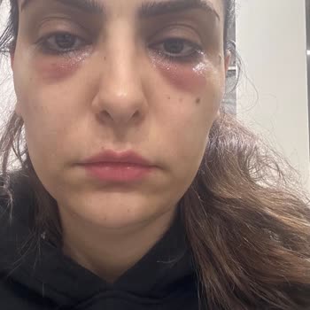 Yanlış Yönlendirme İle Mağduriyet