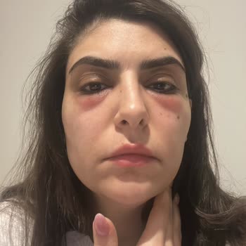 Yanlış Yönlendirme İle Mağduriyet