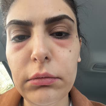 Yanlış Yönlendirme İle Mağduriyet