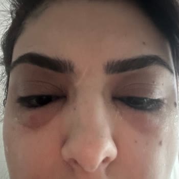 Yanlış Yönlendirme İle Mağduriyet