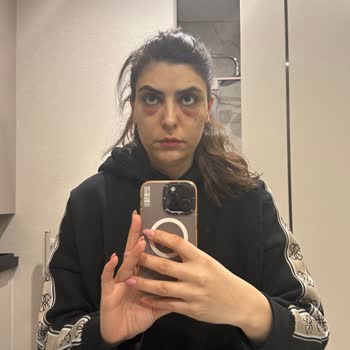 Yanlış Yönlendirme İle Mağduriyet