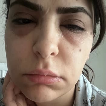 Yanlış Yönlendirme İle Mağduriyet