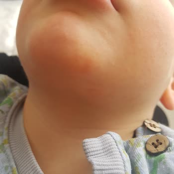 Creme Ultra Serisi Cilt Problemleri Yarattı