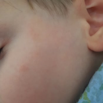 Creme Ultra Serisi Cilt Problemleri Yarattı