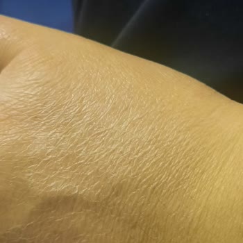 Dermokil Cilt Kuruluğuna Sebep Olan Ürün Sorunu