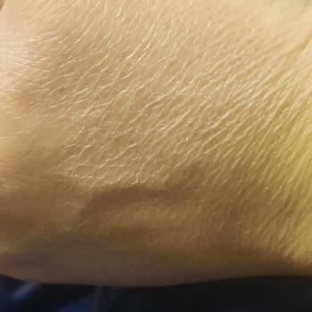 Dermokil Cilt Kuruluğuna Sebep Olan Ürün Sorunu