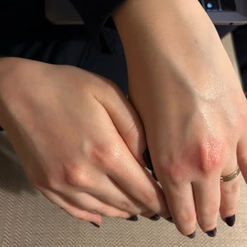 Duru Sıvı Sabun Ellerimi Mahvetti!