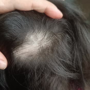 Üni Beybi Saç Spreyi Ve Şampuanı İle Yaşanan Sorunlar