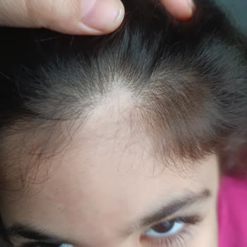 Üni Beybi Saç Spreyi Ve Şampuanı İle Yaşanan Sorunlar