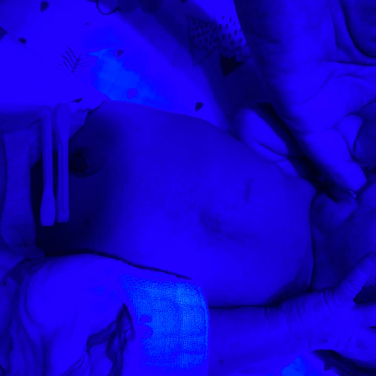 Hastanede Fahiş Ücretler Ve İlgisizlik