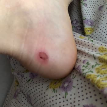 Nine West Botun Sert Topuğu Ayağımı Yaraladı