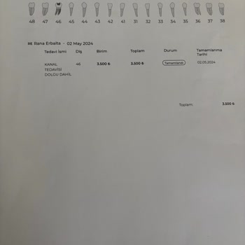 Kanal Tedavisi Sonrası Mağduriyet