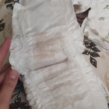 Bebek Bezlerinde Beklenmedik Sorun