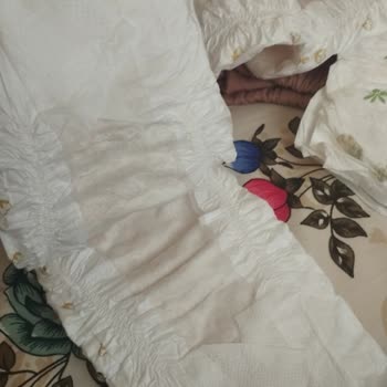 Bebek Bezlerinde Beklenmedik Sorun