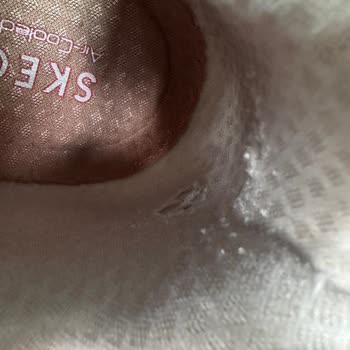 Skechers Ayakkabıda Beklenmeyen Deformasyon