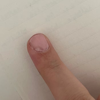 Kadıköy Şubesinde Kalıcı Oje Fiyaskosu