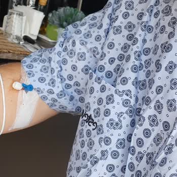 Saç Ekimi Sonrası İlgisizlik Ve Memnuniyetsizlik