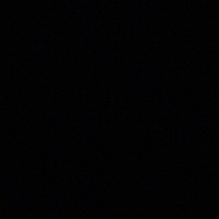 Pronet Cihazımın Pil Sorunu Çözülemiyor: 6 Aylık Bekleyiş