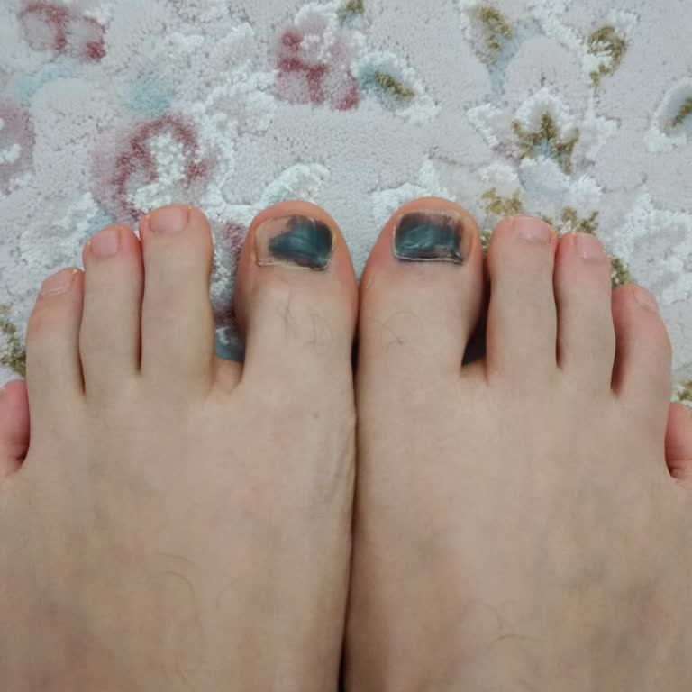 Intersport Kramponlar Ayaklarımı Mahvetti, Mağaza Değişimi Reddetti!