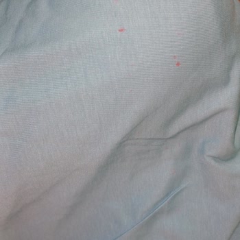 Defolu T-shirtler Ve Yetersiz Müşteri Hizmeti