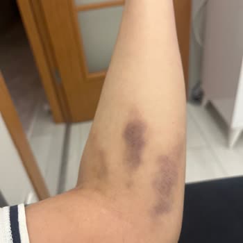 Haydarpaşa Numune Araştırma Hastanesi Yaşadığım Olumsuz Deneyim