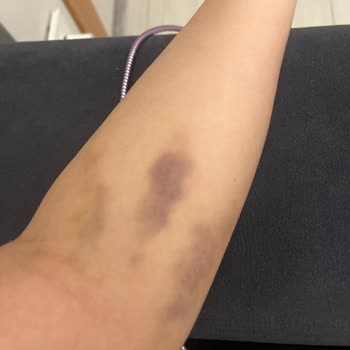 Haydarpaşa Numune Araştırma Hastanesi Yaşadığım Olumsuz Deneyim