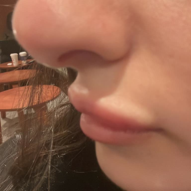 Bakırköy İpek Kirpik | By Selin Beauty Dolgu Faciası: Güzellik Merkezi Mağduriyeti