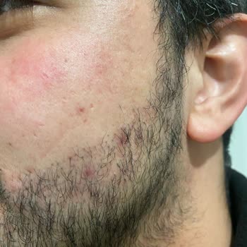 Trendyol'dan Aldığım Ürün Cildimi Mahvetti