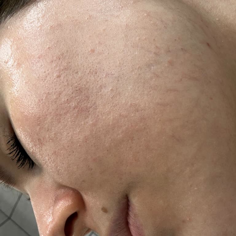 Cilt Ürününden Kaynaklanan Alerjik Reaksiyonlar