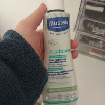 Bebeğimde Kızarıklık Ve Yaraya Neden Olan Krem