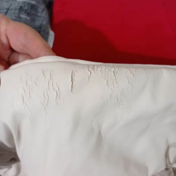 Куртка Koton: облезание кожи и безразличие службы поддержки