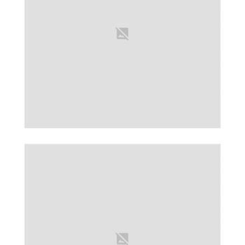 Uppy Uygulaması: İnternet Sorunu Ve Destek Eksikliği