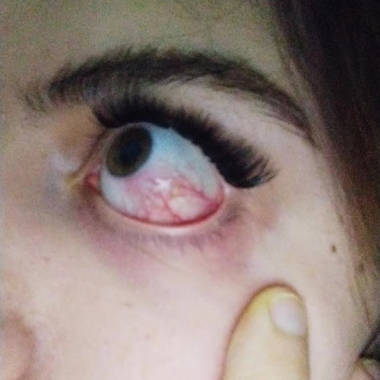 Ella Estetik & Güzellik Merkezi Nevşehir İpek Kirpik Mağduriyeti